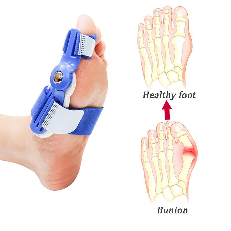 1 pairs Bunion Corrector For Women And Men, Adjustable Splint Pads, Orthopedic Straightener, Separator, Hallux Valgus Day/night Supports, Bunion Corrector For Big Toe