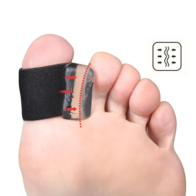 1Pair Big Bone Thumb Toe Separator Bunion Splint Straightener Corrector Foot Care Tools Hallux Valgus Protector Orthotics