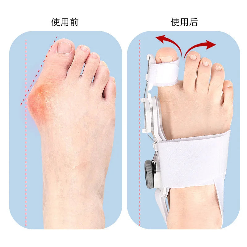 Bunion Corrector Unisex Foot Hallux Valgus Braces Rotatable Toe Separator Straightener Adjustable Pedicure Finger Toe Corrector