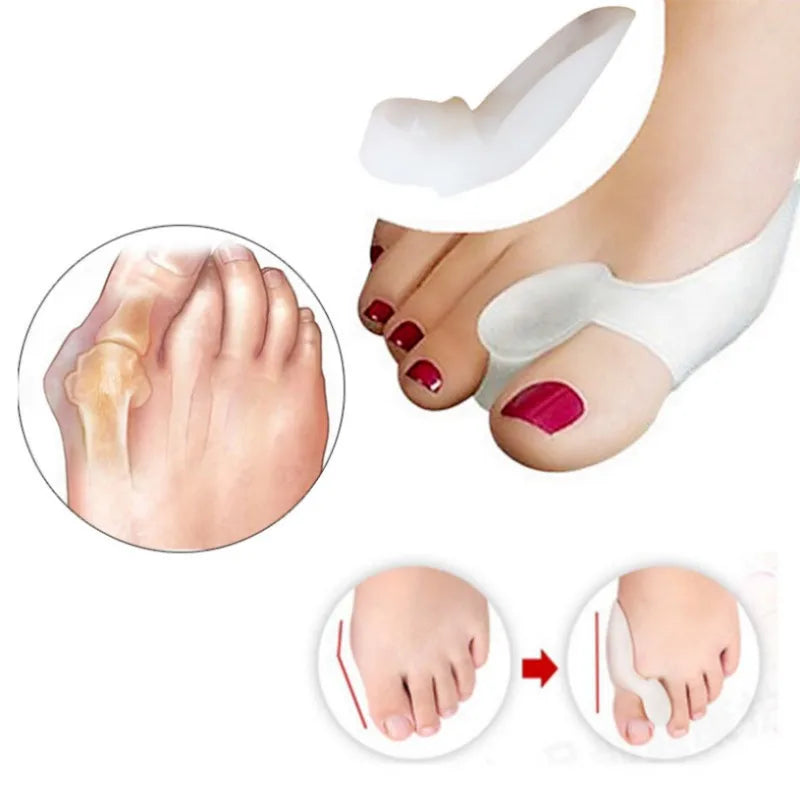 6PCS Silicone Gel Thumb Corrector Bunion Foot Toe Hallux Valgus Protector Separator Finger Straightener Adjuster Foot Care Tool