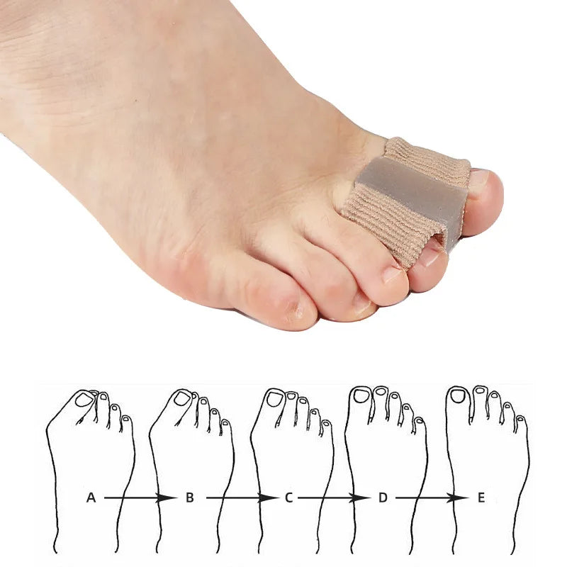 2 Pcs Silicone Toe Spreader Separator Bunion Hallux Valgus Corrector Thumb Finger Correction Straightener Foot Care Tool