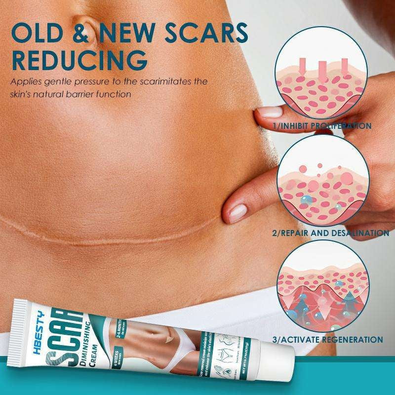 Reusable Silicone Scar Treatment Strips - Professional Quality Scar Reduction Tape for Surgical, C-Section & Injury Scar