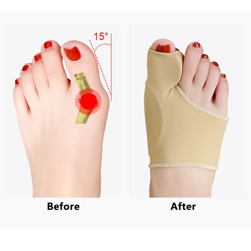 Toe Separator Hallux Valgus Corrector Bunions Valgus Haluksy Finger Separator Haluksy Separator For Toes Bunion Corrector