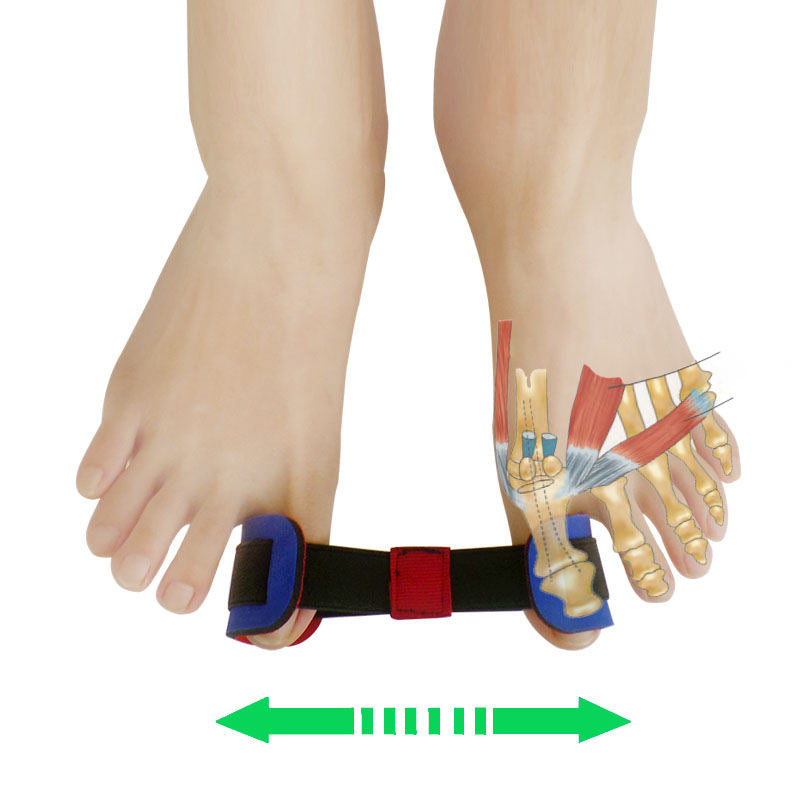 Big Toe Strap Bunion Straightener Stretchy Belt Toe Stretcher Alignment Hallux Valgus Corrector Foot Pain Relief